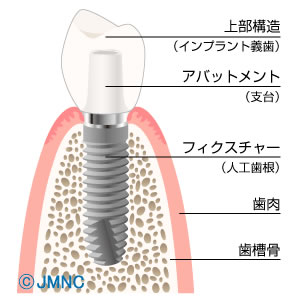 前橋市新堀町・前橋みなみ歯科